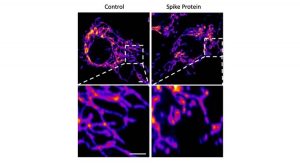 Covid-19 é uma doença vascular e não respiratória, segundo estudo