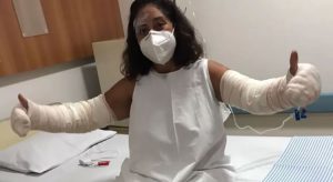 Frasco de desodorante explode, e professora fica com 40% do corpo queimado